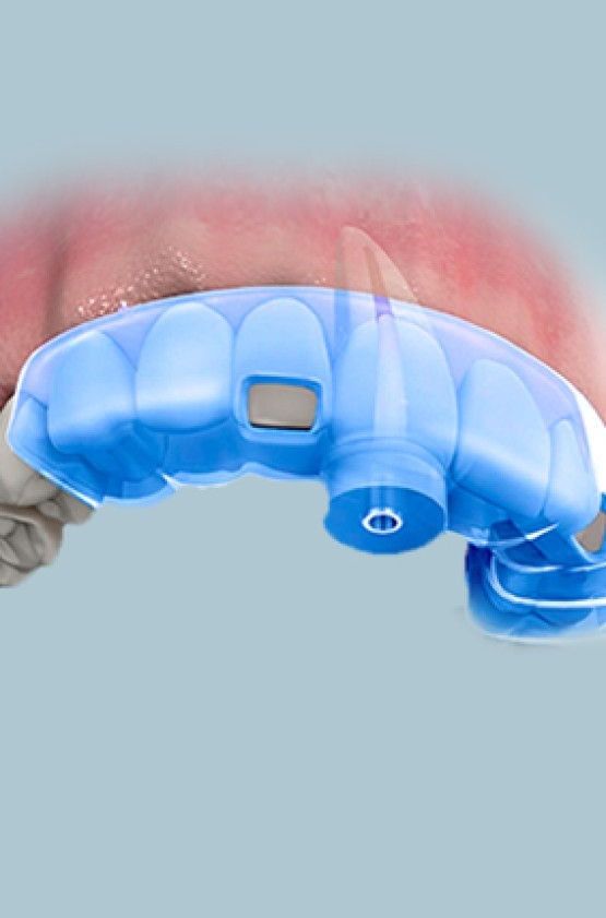 Guias para Endodontia 