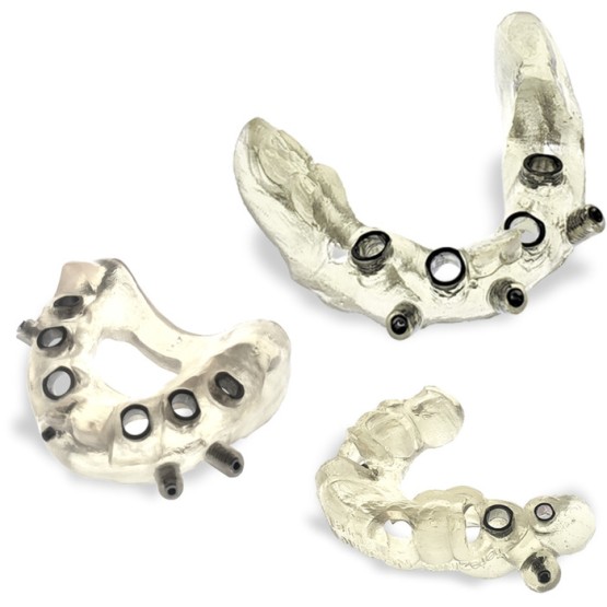 Guia para Implantes